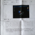 我的相册