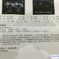 我的相册