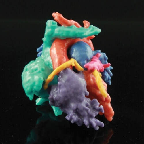Materialise携手上海儿童医学中心 创立中国首家儿科3D数字医学研究中心