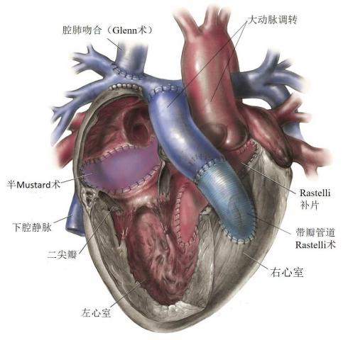 ec1360ba1aacb073fa6bb3c623c08d19_640x480.jpg