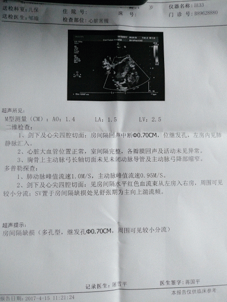 22个月心超
