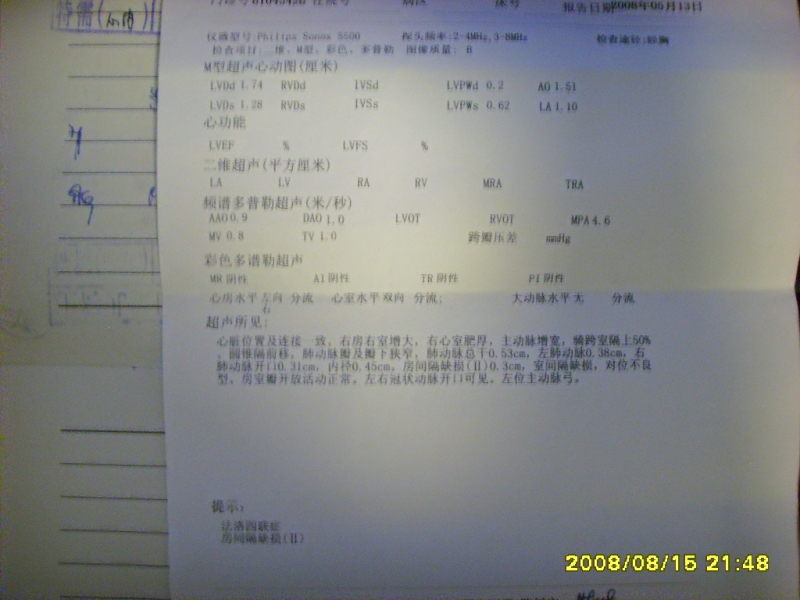 5月心超单子