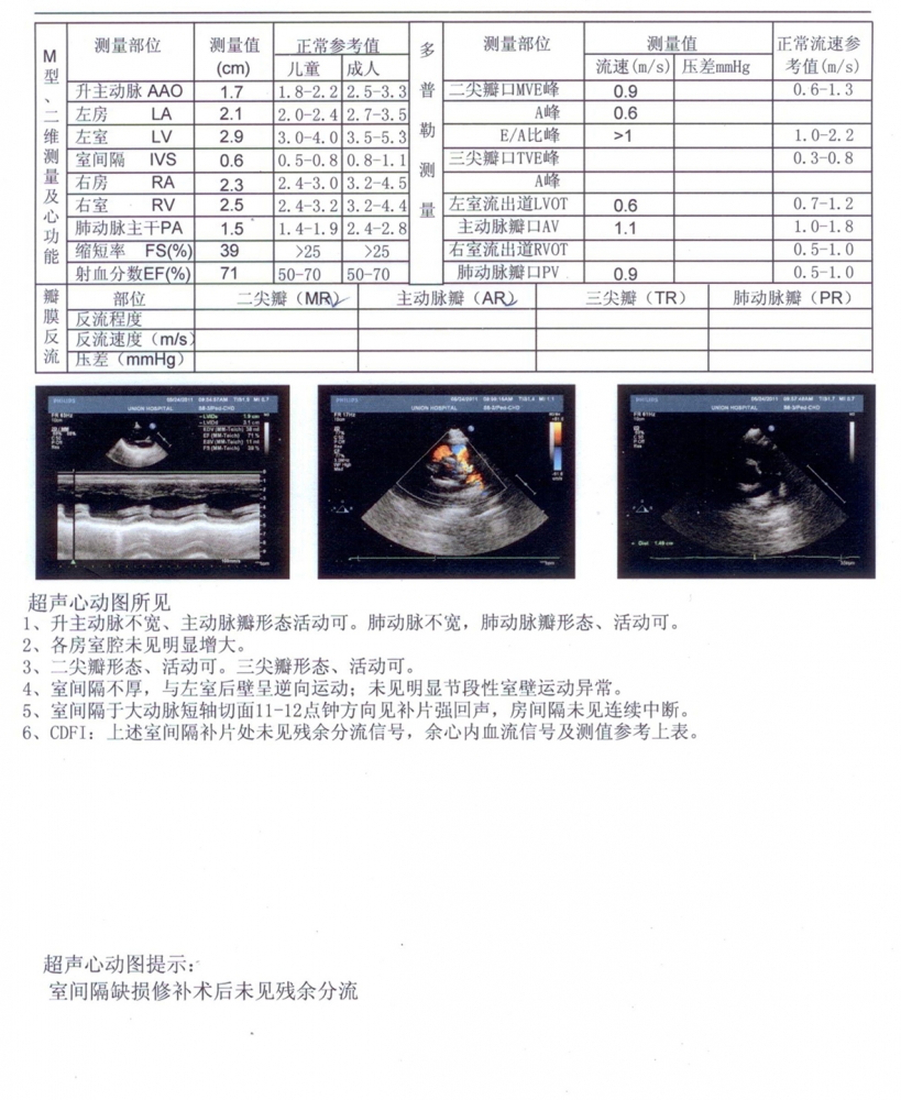 2011.5.24心脏彩超.jpg