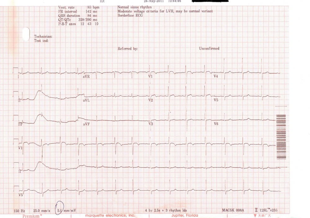 2011.5.24心电图.jpg