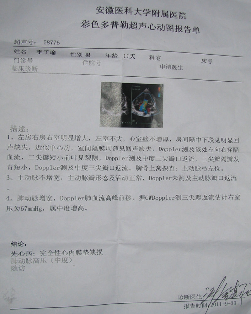 心脏彩超结果