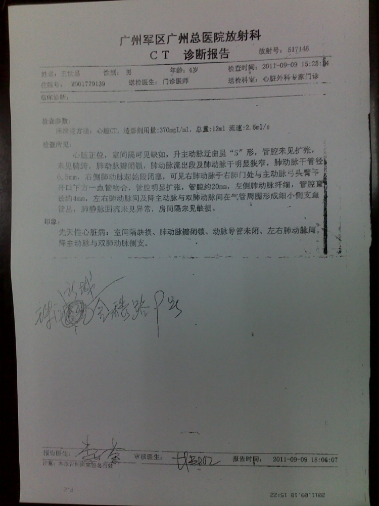 CT结果