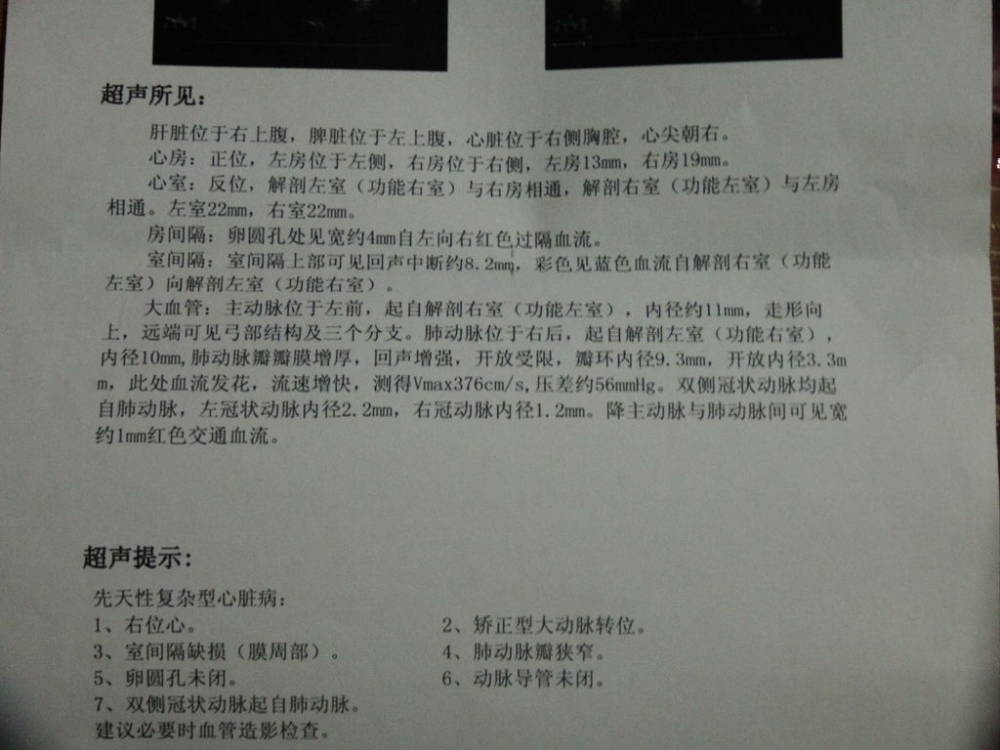 心脏彩超