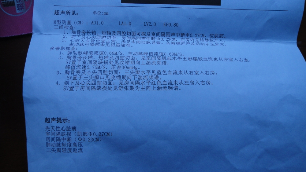 心脏彩超报告单.JPG