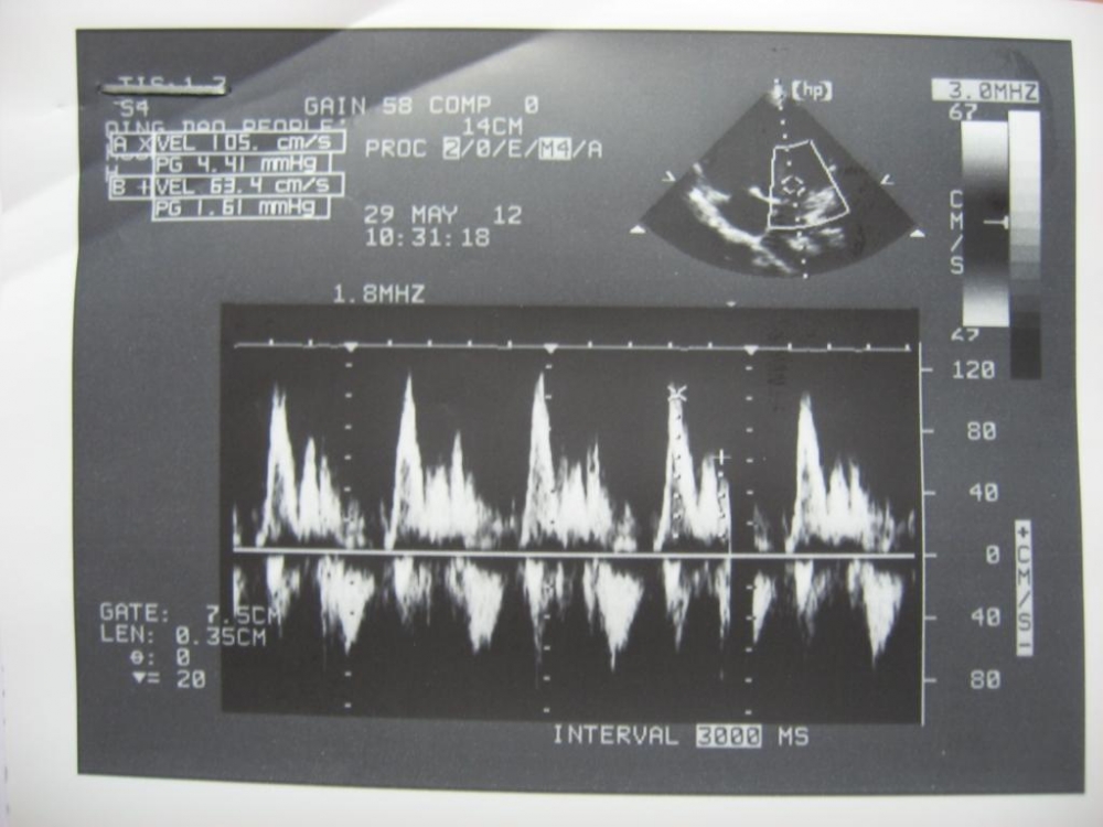 2012年5月28日超声诊断报告单附件