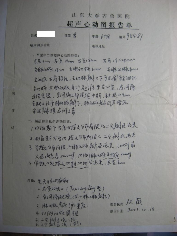 山大齐鲁医院超声心动图报告单（术前）