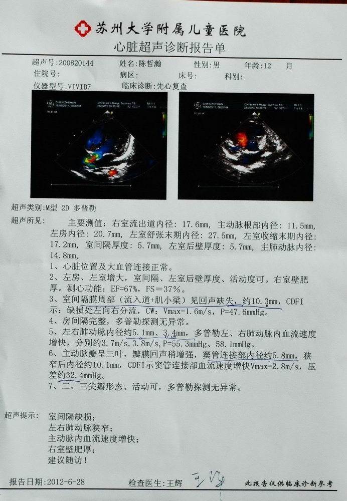 1岁的心超