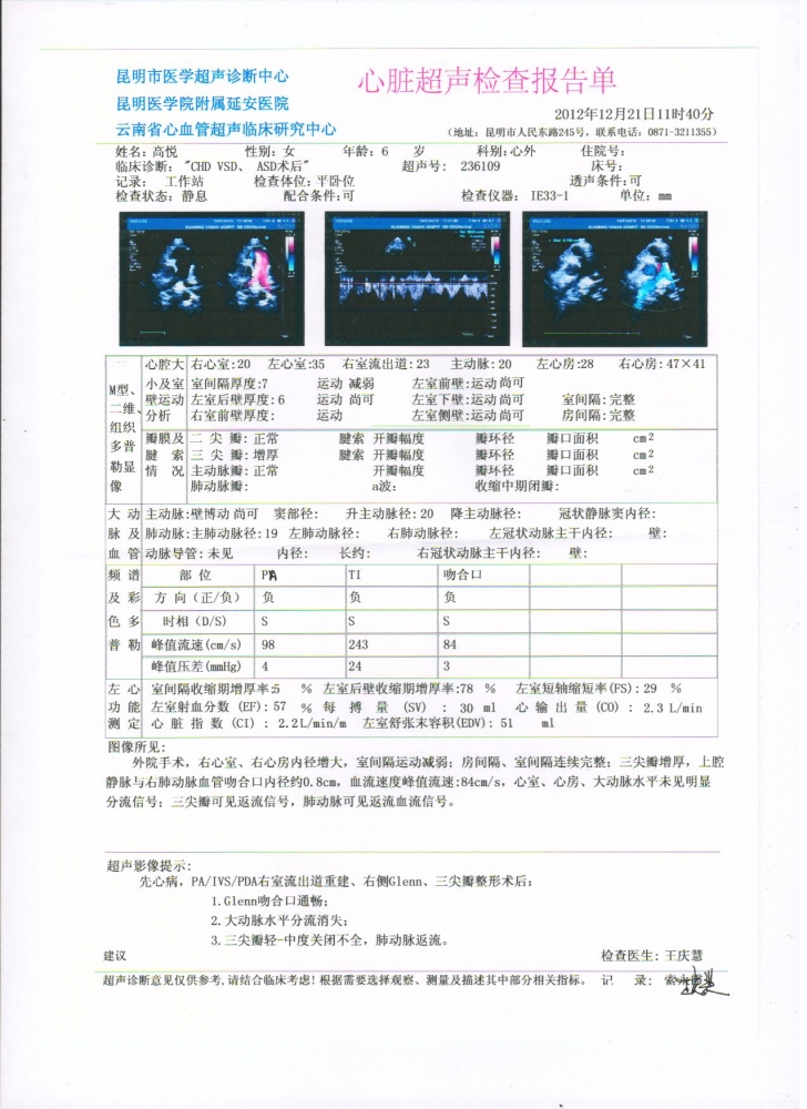 超声报告2012.12.jpg
