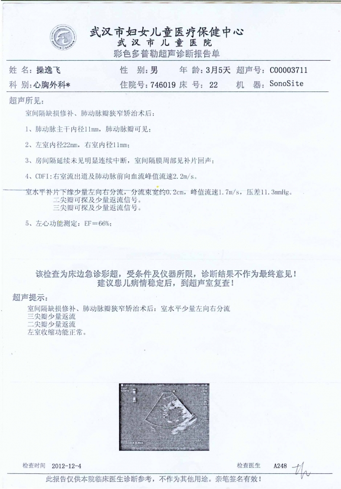 12月4号心脏手术后B超.jpg
