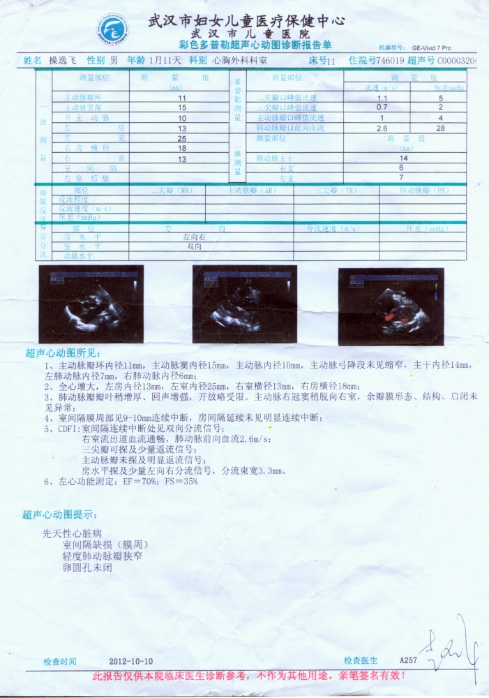 10月10号手术前B超.jpg