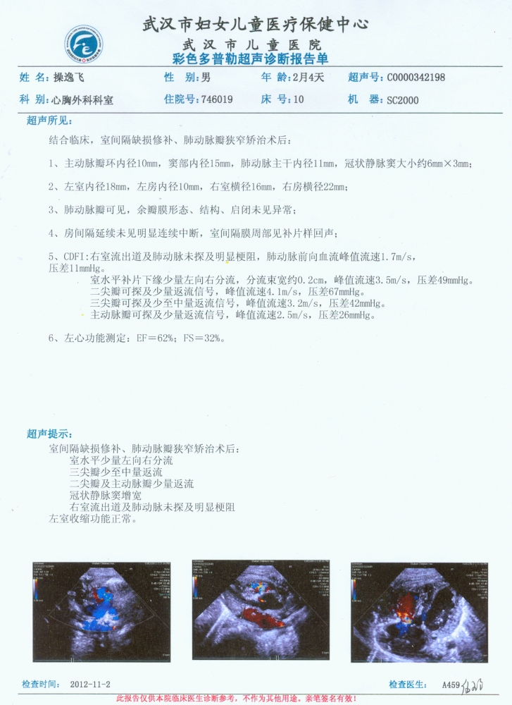 术后11月2号B超单.jpg
