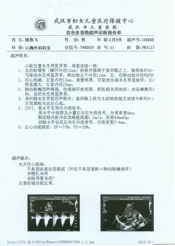 术前B超单.jpg