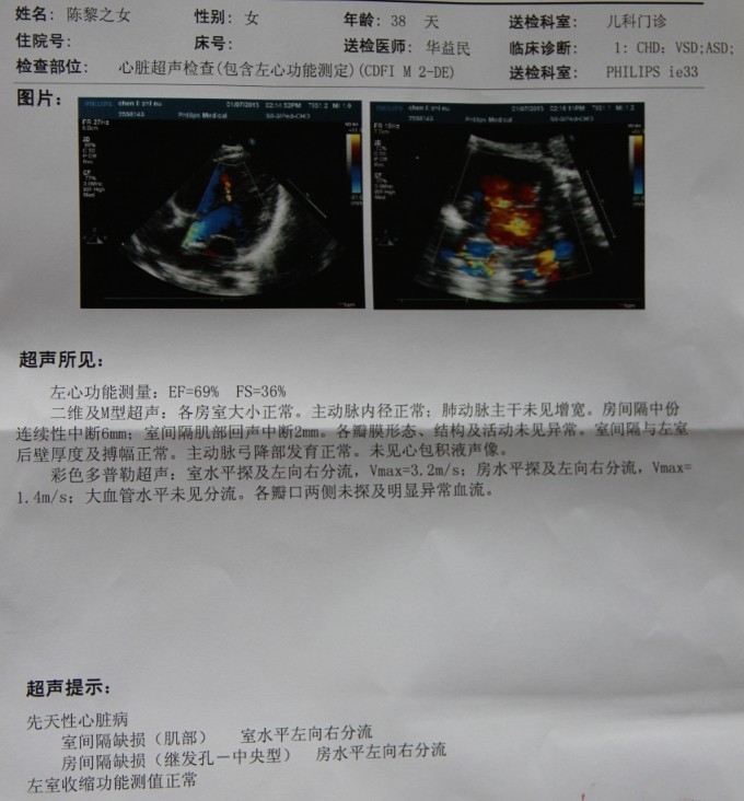 超声心动图检查图文报告