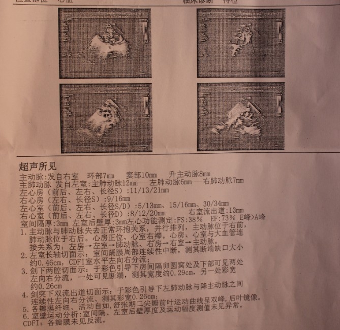 彩超1.jpg
