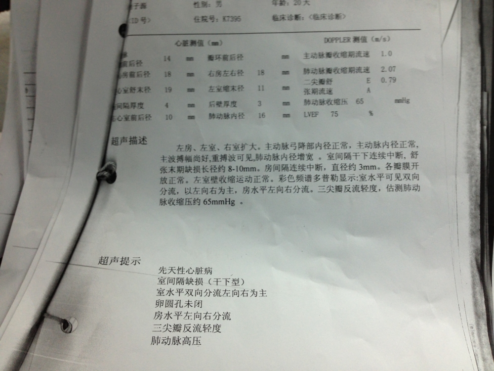 术前.JPG