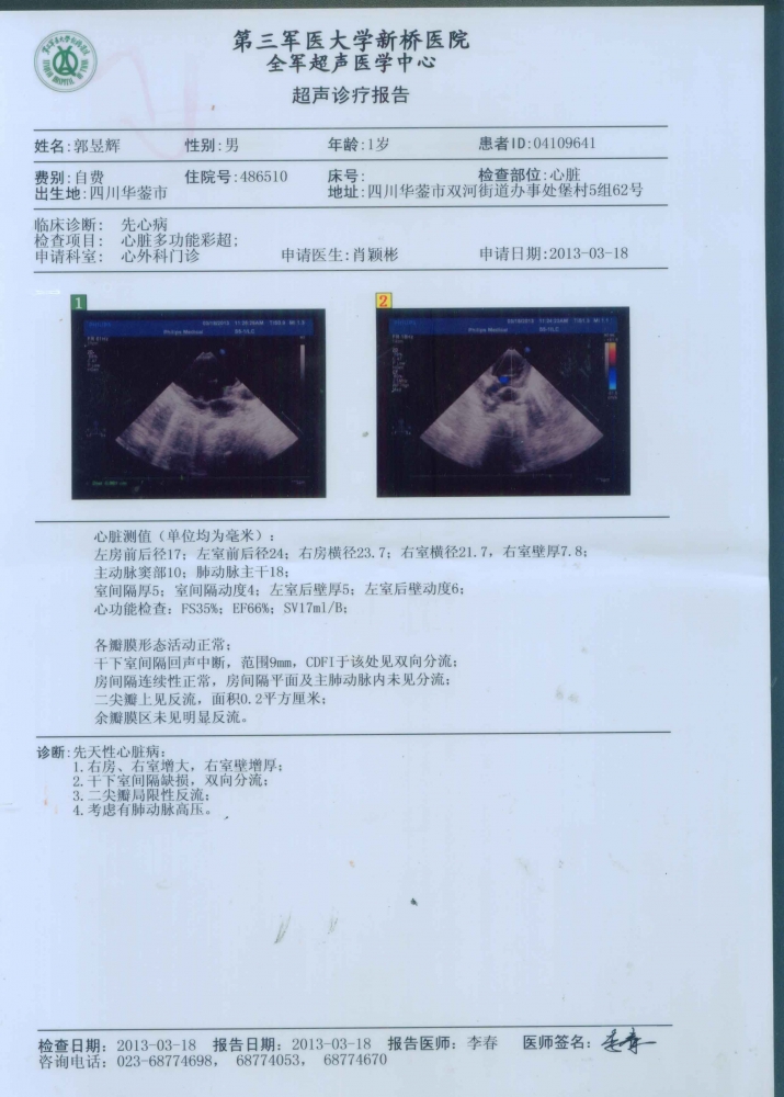 超声.jpg