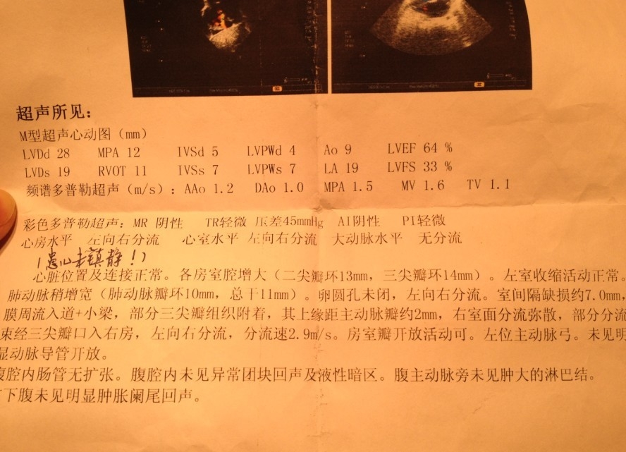 1个月的时候