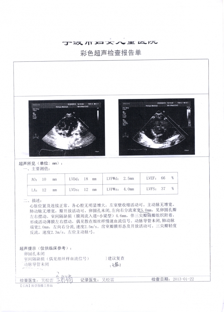出生后