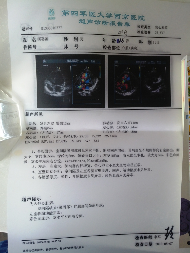 1岁半B超.jpg