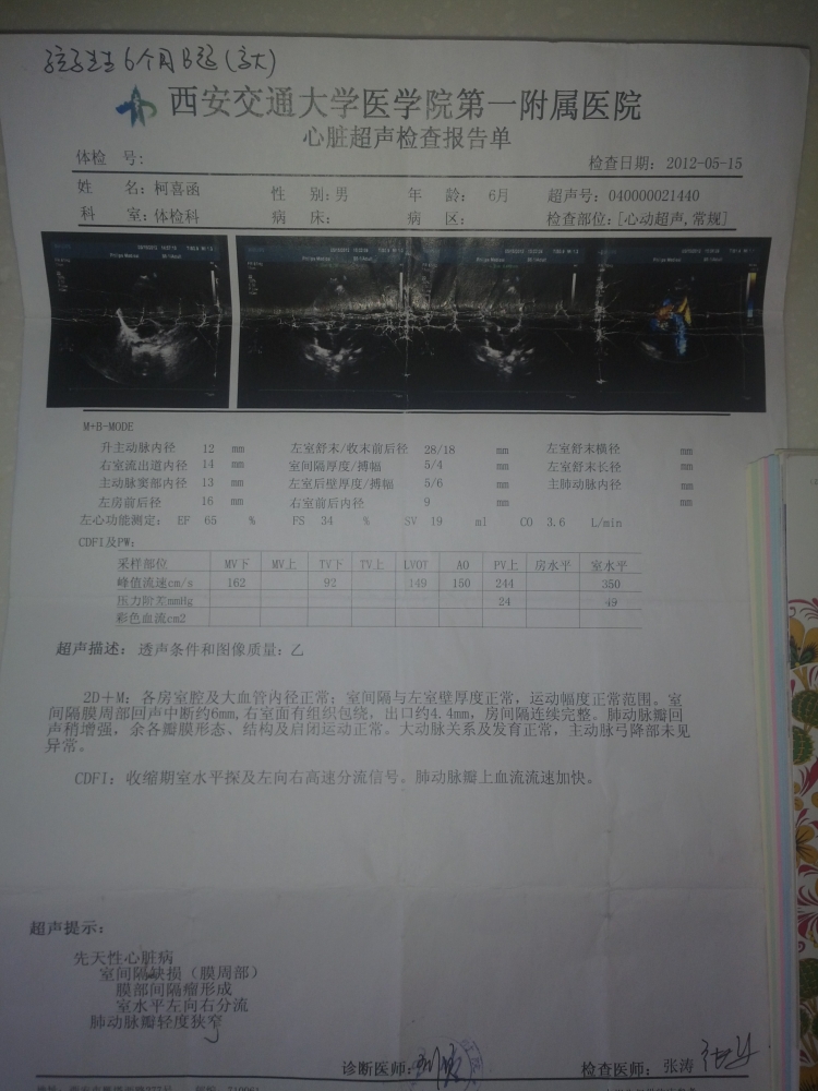 6个月大B超.jpg