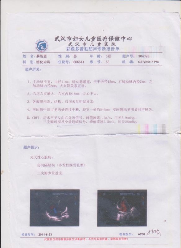 心脏彩超检查(2011).jpeg