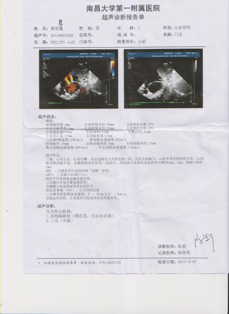 心脏彩超检查2012.jpg