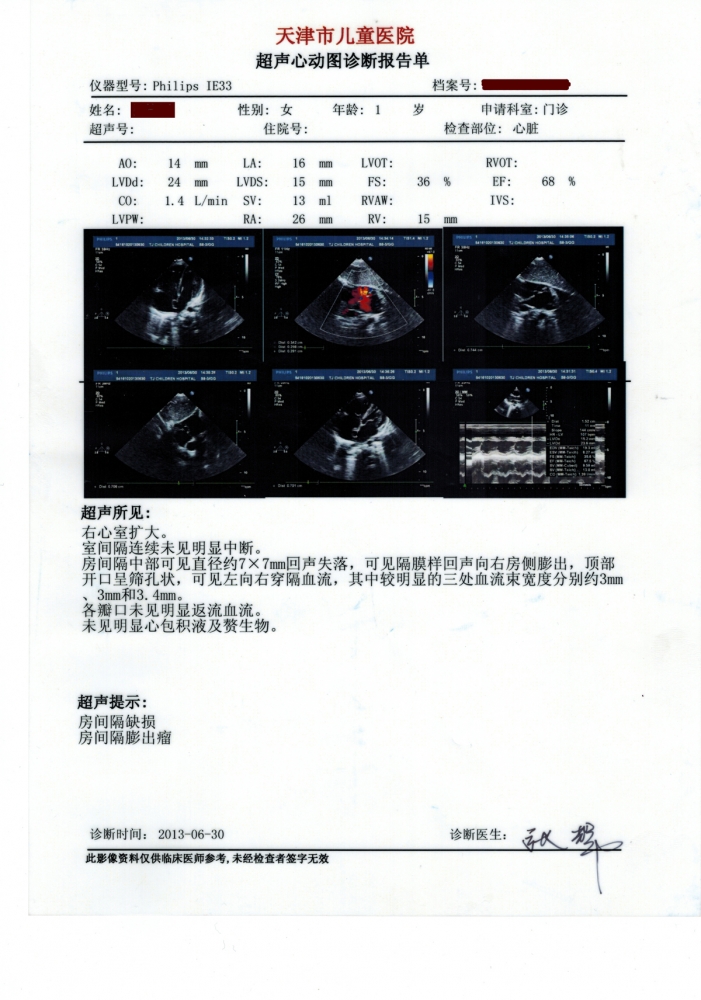 1周岁超声心动检查报告