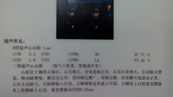 省立儿童医院心脏彩超-1.jpg