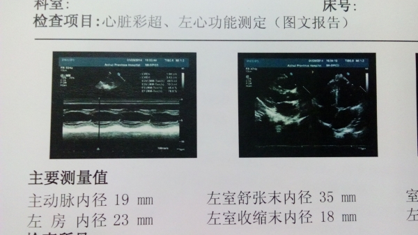 省立医院超声心动-1.jpg