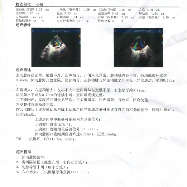 B超单