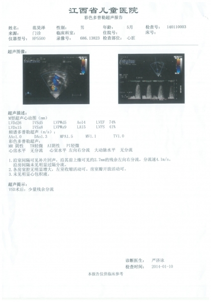 2014年1月10日术后采超.jpg