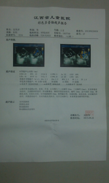 2013年9月22日术前彩超.jpg