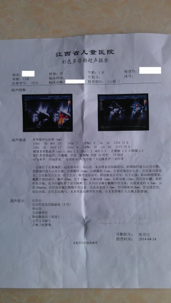 江西省儿童医院心脏彩超1.JPG