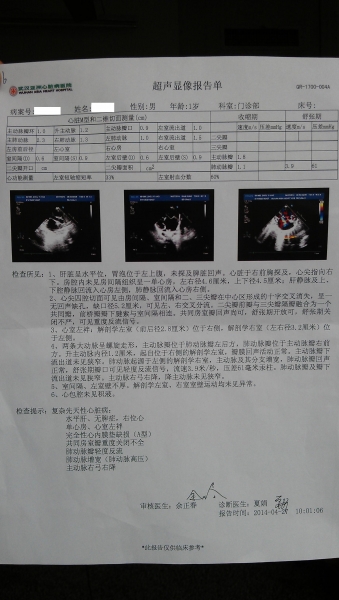 亚洲心脏病医院心脏彩超1.JPG