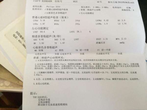 2012年心超单子