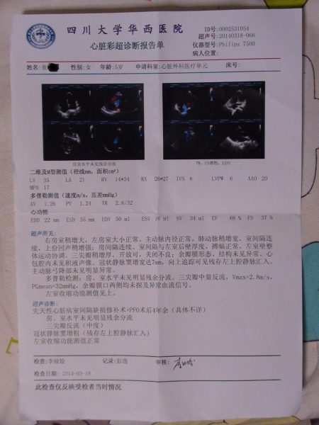 手术后四年半.JPG