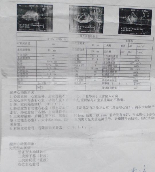 彩超
