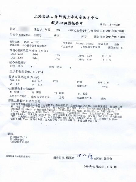 心超