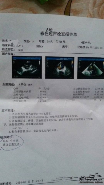 彩超.jpg