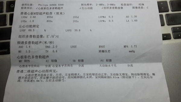 心超