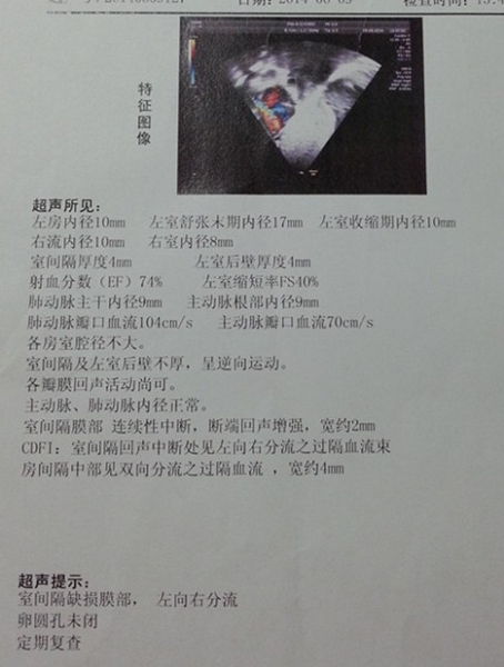 出生第四天拍了彩超