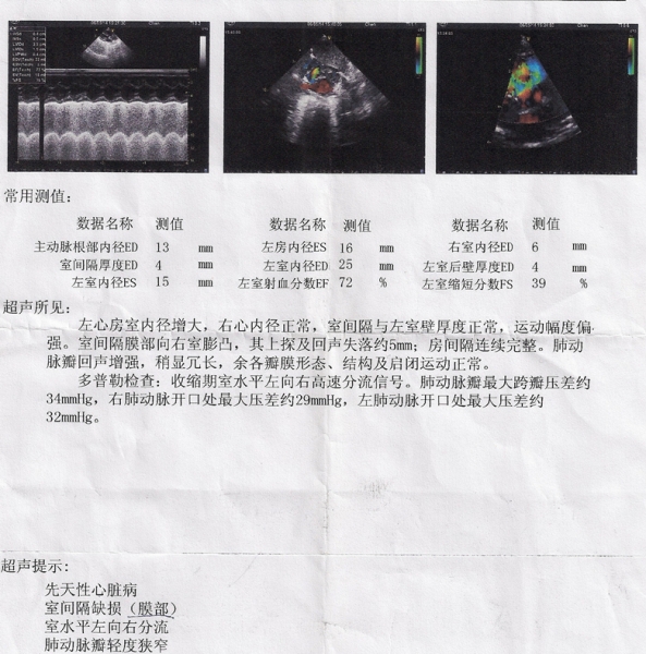 2014.5.06彩超单