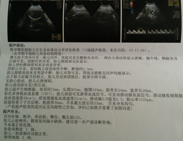 30周彩超
