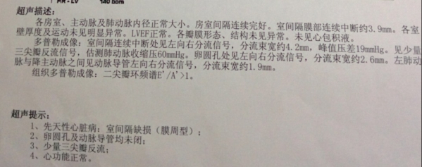 出生后心脏彩超_2