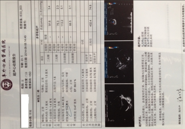 23个月超心动