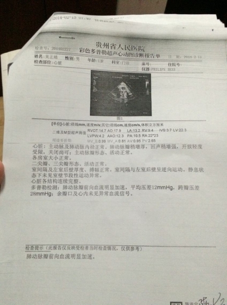 旋转 QQ图片20150117150225.jpg